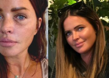 Sylvia Geersen deelt pijnlijke ervaring na onverwacht geweldsincident