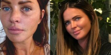 Sylvia Geersen deelt pijnlijke ervaring na onverwacht geweldsincident