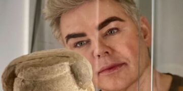 Urk!-ster Teun Föhn beleeft pijnlijke tv-avond: ‘Dit is geen goed verhaal